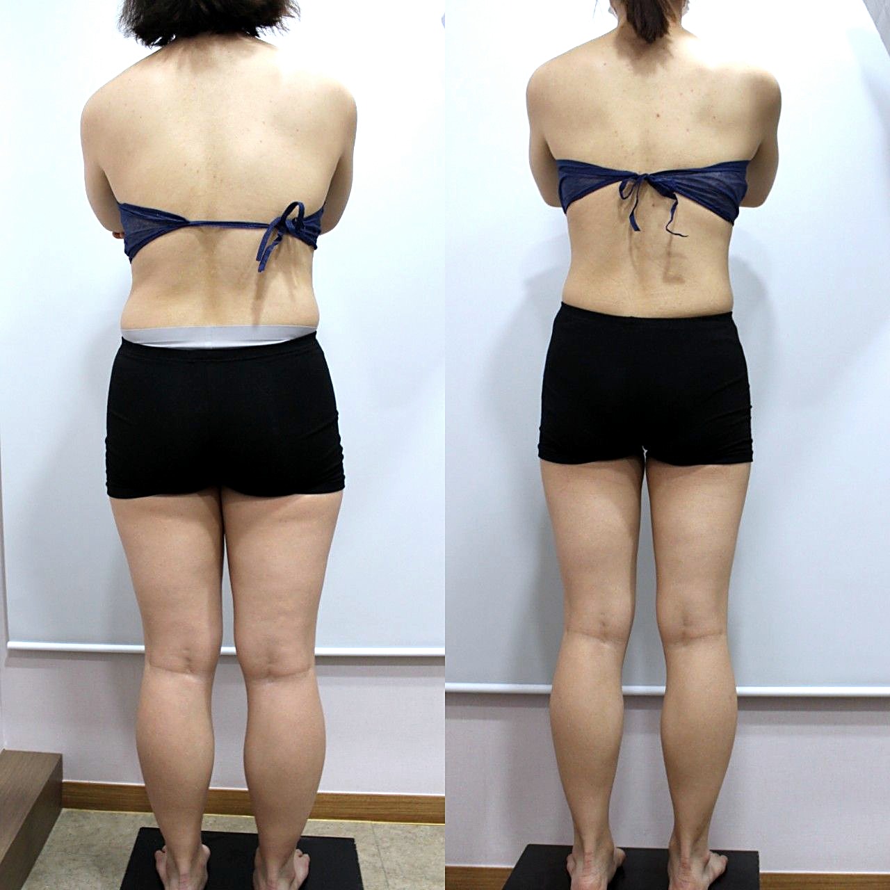 ダイエットプログラム 背面