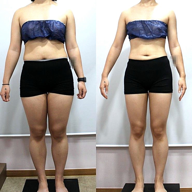 ダイエットプログラム 正面